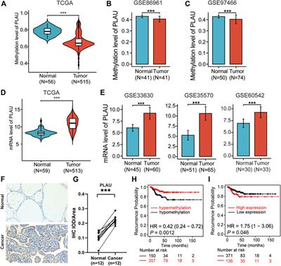 Methylation-Driven Gene PLAU as a Potential Prognostic Marker for Differential Thyroid Carcinoma